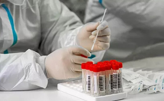 核酸采樣物品準備有哪些 核酸采樣個人防護用品